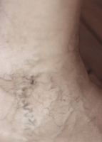 болки в краката - 88653 награди