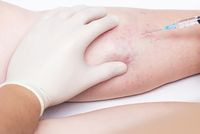 болки в краката - 59743 комбинации