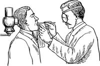 лечение на коренови канали цена - 41304 типа