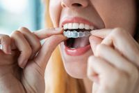 Invisalign - 95335 оферти