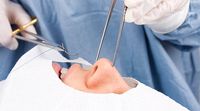циркониеви коронки - 34083 комбинации