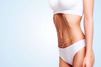 зъбни импланти - 84356 клиенти