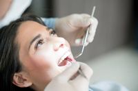 избелване на зъби в домашни условия - 71203 новини