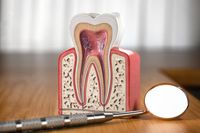 избелване на зъби в домашни условия - 48037 варианти