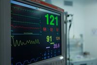 пулсоксиметри - 2071 селекции