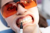 циркониеви коронки - 64722 постижения