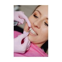 зъбни импланти Варна - 76788 клиенти