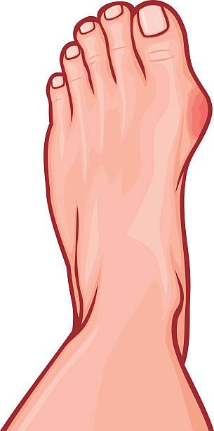 Разделители за пръсти - 93514 постижения