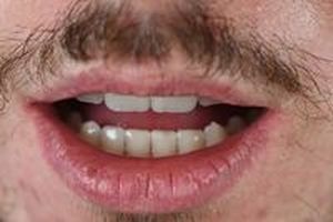 дентална клиника софия - 94493 типа